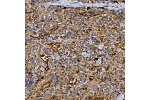 Immunohistochemistry of paraffin-embedded rat spleen using CD26/DPP4 Rabbit pAb (ABIN6130064, ABIN6139794, ABIN6139795 and ABIN6218546) at dilution of 1:25 (40x lens). (DPP4 抗体  (AA 29-280))