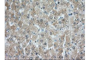 Immunohistochemical staining of paraffin-embedded Human prostate tissue using anti-RAB17 mouse monoclonal antibody. (RAB17 抗体)