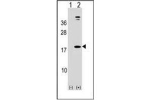 Western blot analysis of LEP (arrow) using Leptin Antibody (N-term) Cat. (Leptin 抗体  (N-Term))