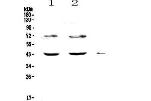 Western blot analysis of TSPAN12 using anti-TSPAN12 antibody .