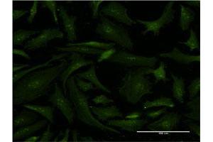 Immunofluorescence (IF) image for anti-Excision Repair Cross-Complementing Rodent Repair Deficiency, Complementation Group 2 (ERCC2) (AA 631-730) antibody (ABIN515385)