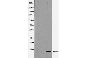 Western blot analysis of SDF 1 expression in HepG2 cells,The lane on the left is treated with the antigen-specific peptide. (CXCL12 抗体  (C-Term))