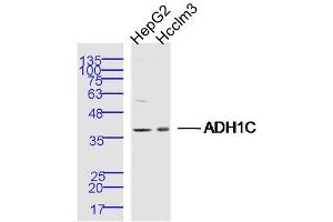 Lane 1: Hepg2 lysates Lane 2: Hcclm3 lysates probed with ADH1C Polyclonal Antibody, Unconjugated  at 1:300 dilution and 4˚C overnight incubation. (ADH1C 抗体  (AA 281-375))