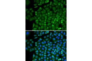 Immunofluorescence (IF) image for anti-Selenium Binding Protein 1 (SELENBP1) (AA 243-472) antibody (ABIN1513508) (SELENBP1 抗体  (AA 243-472))