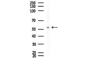 Western blot analysis of lysates from Rat brain, using ARMC6 Antibody at 1/1000 dilution.