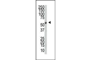 Western blot analysis of anti-SRPK2 Pab (ABIN391795 and ABIN2841650) in mouse thymus tissue lysate. (SRPK2 抗体  (C-Term))