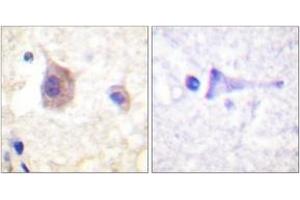 Immunohistochemistry analysis of paraffin-embedded human brain, using PKD1/PKC mu (Phospho-Tyr463) Antibody. (PKC mu 抗体  (pTyr463))