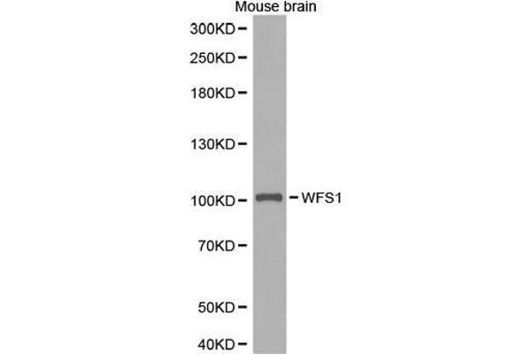 WFS1 抗体  (AA 1-285)