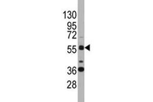 Western blot analysis of SOX9 antibody and K562 lysate. (SOX9 抗体  (AA 41-70))