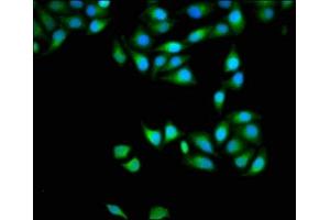 Immunofluorescence staining of Hela cells with ABIN7150152 at 1:133, counter-stained with DAPI. (APOBEC3D 抗体  (AA 250-371))