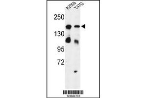 Western blot analysis of HDLBP Antibody in A2058, T47D cell line lysates (35ug/lane)