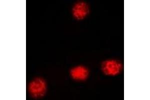 Immunofluorescent analysis of XRCC3 staining in HeLa cells.
