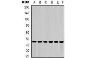 Western blot analysis of Cytokeratin 18 expression in HepG2 (A), Hela (B), mouse liver (C), mouse skeletal muscle (D), C2C12 (E), rat heart (F) whole cell lysates. (Cytokeratin 18 抗体)