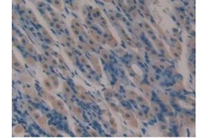 Detection of LTF in Mouse Stomach Tissue using Polyclonal Antibody to Lactoferrin (LTF) (Lactoferrin 抗体  (AA 63-193))