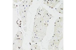 Immunohistochemistry of paraffin-embedded mouse heart using SFPQ antibody (ABIN5970351) at dilution of 1/100 (40x lens). (SFPQ 抗体)
