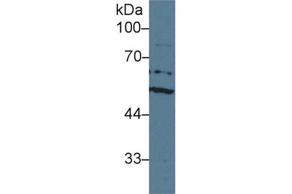 Acetylcholinesterase 抗体  (AA 157-332)