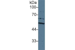 Detection of ACHE in Human HepG2 cell lysate using Polyclonal Antibody to Acetylcholinesterase (ACHE) (Acetylcholinesterase 抗体  (AA 157-332))