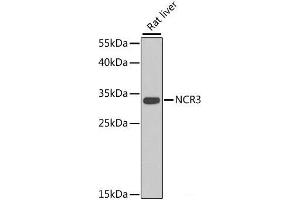 Western blot analysis of extracts of Rat liver using NCR3 Polyclonal Antibody at dilution of 1:1000. (NCR3 抗体)