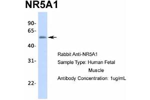 Host:  Rabbit  Target Name:  NR5A1  Sample Type:  Human Fetal Muscle  Antibody Dilution:  1.