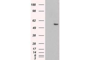 Image no. 3 for anti-Keratin 8 (KRT8) (AA 91-381) antibody (ABIN1491712)