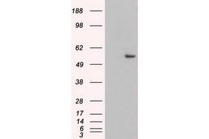 Image no. 3 for anti-Keratin 8 (KRT8) (AA 91-381) antibody (ABIN1491712) (KRT8 抗体  (AA 91-381))
