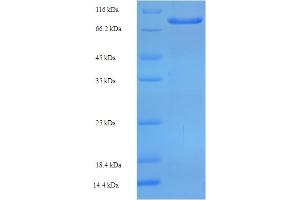 SDS-PAGE (SDS) image for Zinc Finger Protein 165 (ZNF165) (AA 1-485), (full length) protein (His-SUMO Tag) (ABIN5710646)