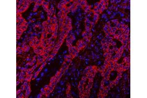 IF analysis of CLASP1 using anti-CLASP1 antibody (ABIN7599144). (CLASP1 抗体  (AA 1-243))