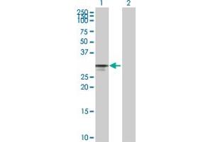 Lane 1: CDK4 transfected lysate ( 33. (CDK4 293T Cell Transient Overexpression Lysate(Denatured))