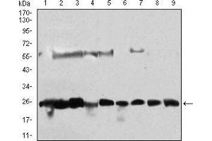 Western blot analysis using CSNK2B mouse mAb against Hela (1), Jurkat (2), K562 (3), HepG2 (4), C6 (5), SK-N-SH (6), NTERA-2 (7), MCF-7 (8), NIH/3T3 (9) cell lysate. (CSNK2B 抗体  (AA 1-215))