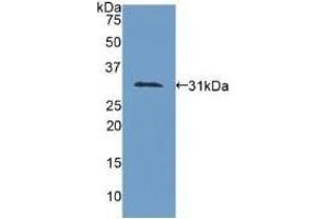 Detection of Recombinant COL4a1, Human using Polyclonal Antibody to Collagen Type IV Alpha 1 (COL4a1) (COL4A1 抗体  (AA 1444-1669))