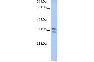 WB Suggested Anti-RG9MTD3 Antibody Titration:  0. (RG9MTD3 抗体  (N-Term))