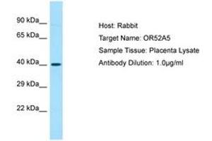 Image no. 1 for anti-Olfactory Receptor 52A5 (OR52A5) (C-Term) antibody (ABIN6749903) (OR52A5 抗体  (C-Term))