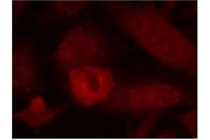 Image no. 1 for anti-Insulin Receptor Substrate 1 (IRS1) (Ser639) antibody (ABIN197468)