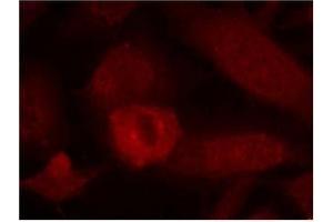 Image no. 1 for anti-Insulin Receptor Substrate 1 (IRS1) (Ser639) antibody (ABIN197469) (IRS1 抗体  (Ser639))