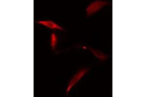 ABIN6274829 staining A549 cells by IF/ICC. (AKR1E2 抗体  (Internal Region))