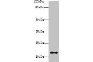 Western blot All lanes: JAGN1 antibody at 3 μg/mL + HL60 whole cell lysate Secondary Goat polyclonal to rabbit IgG at 1/10000 dilution Predicted band size: 22 kDa Observed band size: 22 kDa (JAGN1 抗体  (AA 1-39))