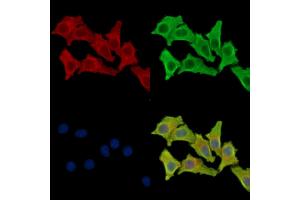 ABIN7096190 and ABIN7100252 staining Hela cells by IF/ICC.