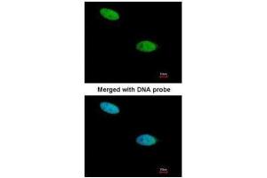 ICC/IF Image Immunofluorescence analysis of paraformaldehyde-fixed HeLa, using DUSP26, antibody at 1:200 dilution. (DUSP26 抗体  (Center))