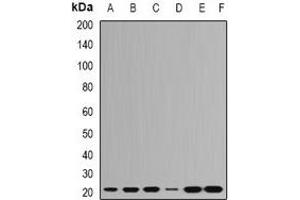 Western blot analysis of RPL9 expression in Hela (A), HepG2 (B), SHSY5Y (C), Jurkat (D), mouse brain (E), mouse spleen (F) whole cell lysates.
