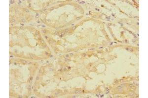 Immunohistochemistry of paraffin-embedded human kidney tissue using ABIN7160526 at dilution of 1:100 (PDE4DIP 抗体  (AA 1-310))