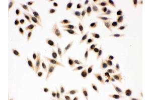 Immunohistochemistry (IHC) image for anti-Nibrin (NBN) (AA 714-745), (C-Term) antibody (ABIN3043282)