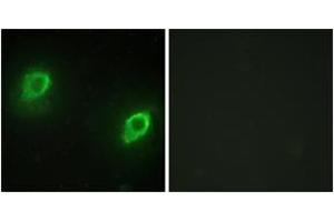 Immunofluorescence analysis of HeLa cells, using AKAP5 Antibody. (AKAP5 抗体  (AA 1-50))