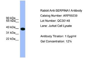 Western Blotting (WB) image for anti-serpin Peptidase Inhibitor, Clade A (Alpha-1 Antiproteinase, Antitrypsin), Member 1 (SERPINA1) (C-Term) antibody (ABIN2787988)
