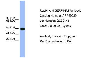 WB Suggested Anti-SERPINA1  Antibody Titration: 0. (SERPINA1 抗体  (C-Term))