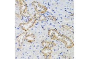 Immunohistochemistry of paraffin-embedded rat kidney using MTERFD3 antibody at dilution of 1:100 (x40 lens). (MTERFD3 抗体)