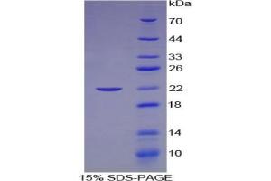 SDS-PAGE of Protein Standard from the Kit  (Highly purified E. (LAMC2 ELISA 试剂盒)