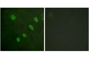 Immunofluorescence analysis of HeLa cells, using ATF2 (Phospho-Ser480) Antibody. (ATF2 抗体  (pSer480))