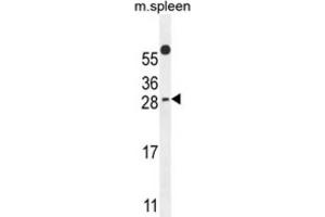 Western Blotting (WB) image for anti-Partner of Y14 and mago (WIBG) antibody (ABIN2995794) (PYM 抗体)
