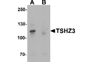 Western blot analysis of TSHZ3 in mouse brain tissue lysate with TSHZ3 antibody at 1 µg/mL in (A) the absence and (B) the presence of blocking peptide. (TSHZ3 抗体  (N-Term))
