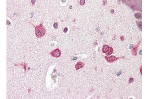Human Brain, Cortex (formalin-fixed, paraffin-embedded) stained with TSLPat 2. (Thymic Stromal Lymphopoietin 抗体)